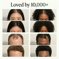 The Korean Scalp Revival Bar